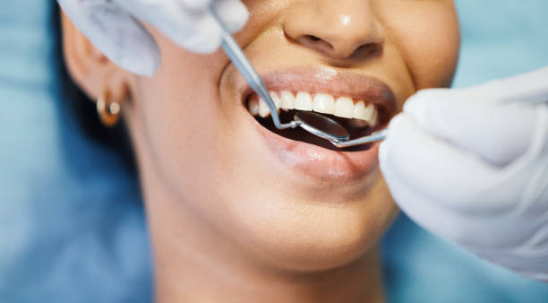 Best Emergency Dentist for Knocked-Out Tooth in Ashland, OH